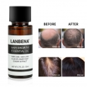 Professional LANBENA Faster Grow Hair Care Dense Hair Growth Essential Oil Hair Loss Products Root Extract Hair Growth 20ML